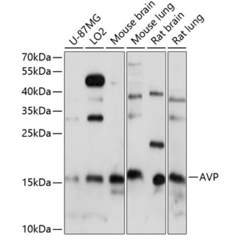 Western Blot - Anti-Vasopressin Antibody (A88548) - Antibodies.com