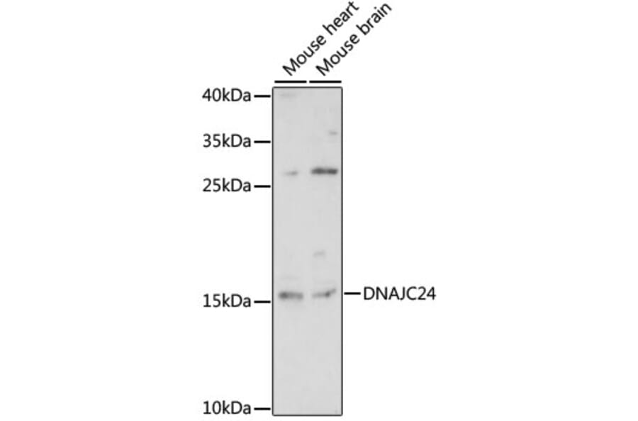 Western Blot - Anti-DPH4 Antibody (A88549) - Antibodies.com