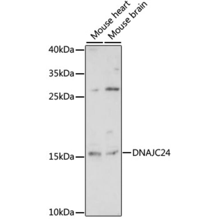Western Blot - Anti-DPH4 Antibody (A88549) - Antibodies.com