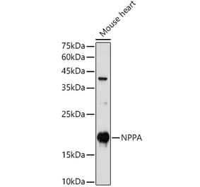 Western Blot - Anti-Natriuretic peptides A Antibody (A88550) - Antibodies.com
