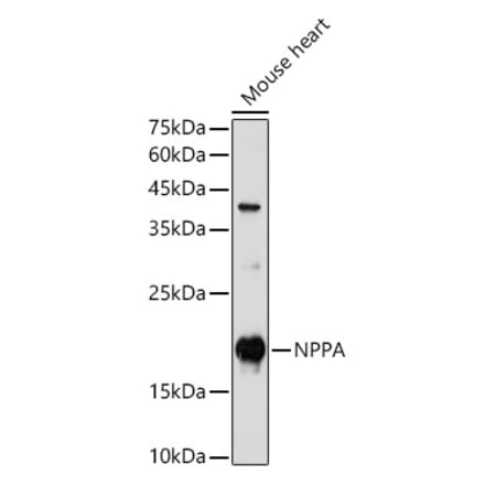 Western Blot - Anti-Natriuretic peptides A Antibody (A88550) - Antibodies.com