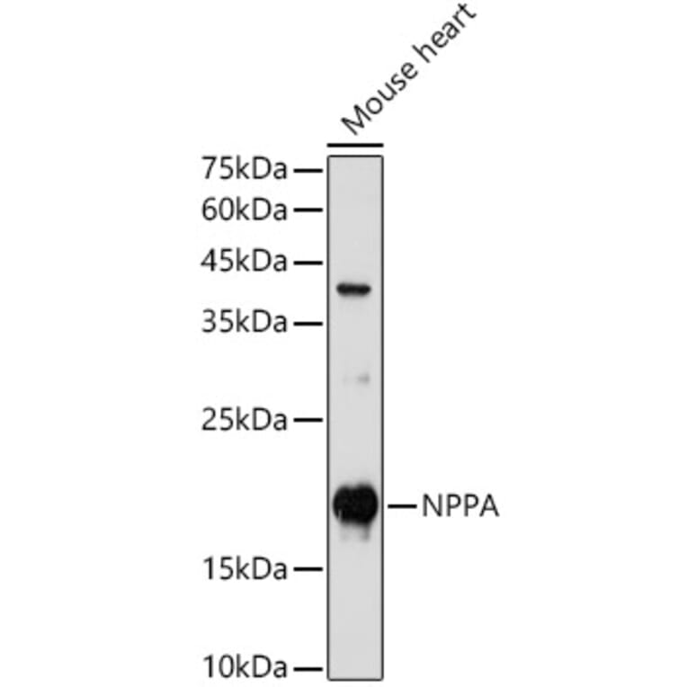 Western Blot - Anti-Natriuretic peptides A Antibody (A88550) - Antibodies.com
