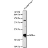 Western Blot - Anti-Natriuretic peptides A Antibody (A88550) - Antibodies.com