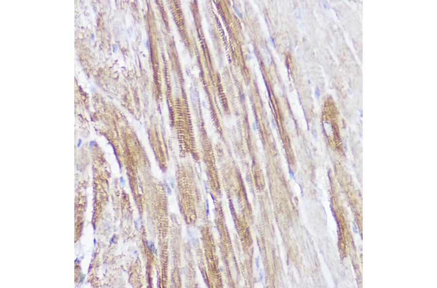 Immunohistochemistry - Anti-Natriuretic peptides A Antibody (A88550) - Antibodies.com