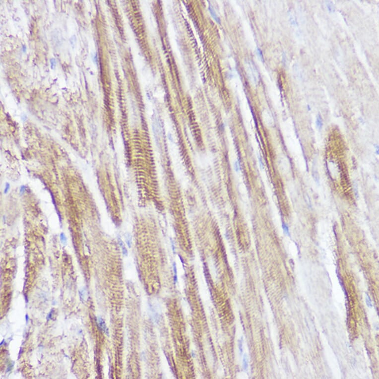 Immunohistochemistry - Anti-Natriuretic peptides A Antibody (A88550) - Antibodies.com