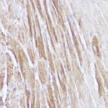 Immunohistochemistry - Anti-Natriuretic peptides A Antibody (A88550) - Antibodies.com