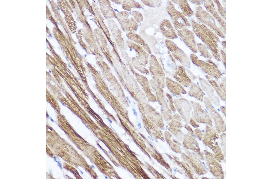 Immunohistochemistry - Anti-Natriuretic peptides A Antibody (A88550) - Antibodies.com