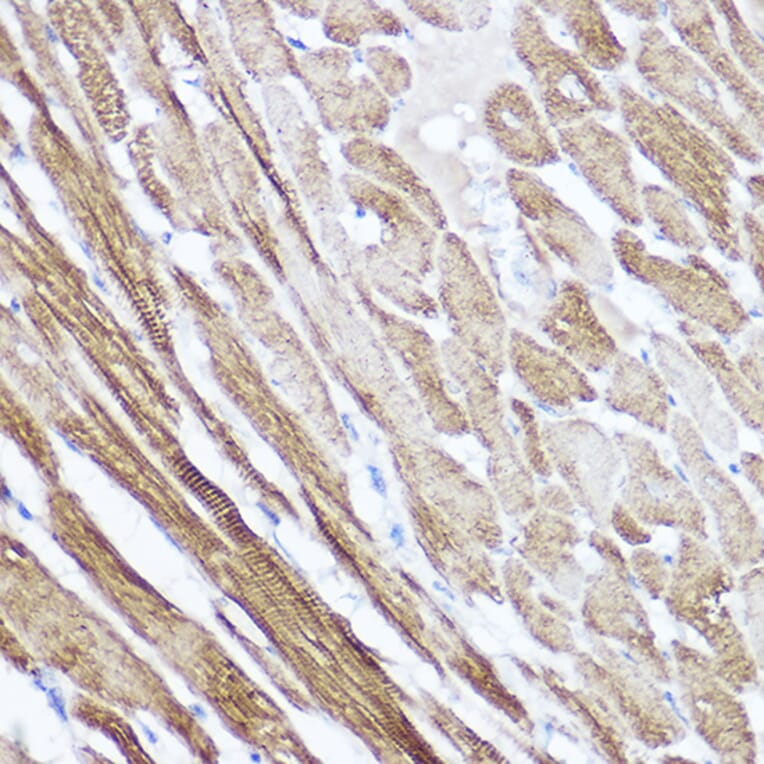 Immunohistochemistry - Anti-Natriuretic peptides A Antibody (A88550) - Antibodies.com