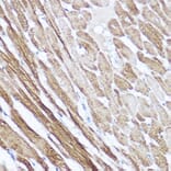 Immunohistochemistry - Anti-Natriuretic peptides A Antibody (A88550) - Antibodies.com