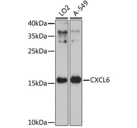 Western Blot - Anti-GCP2 Antibody (A88551) - Antibodies.com