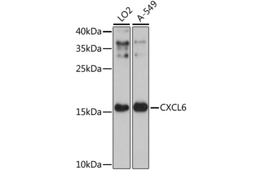 Western Blot - Anti-GCP2 Antibody (A88551) - Antibodies.com