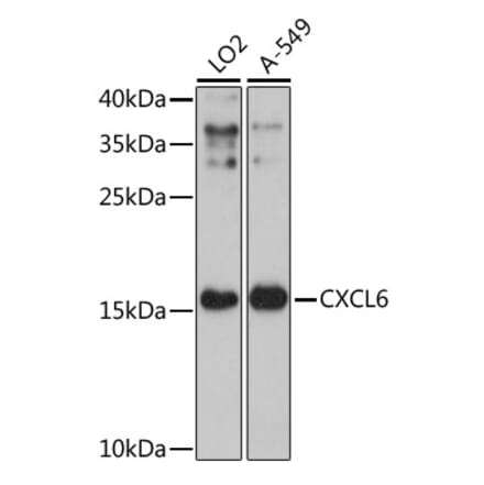 Western Blot - Anti-GCP2 Antibody (A88551) - Antibodies.com