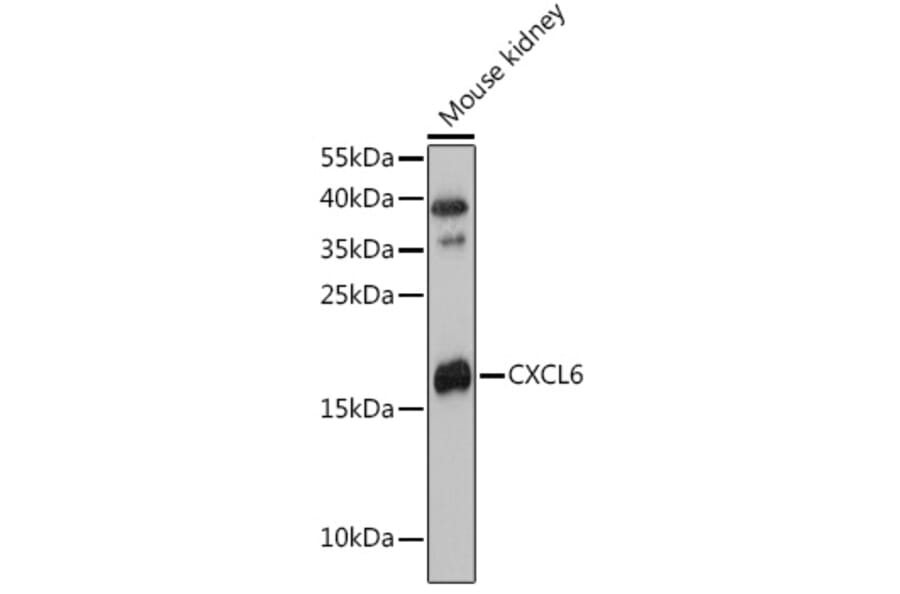 Western Blot - Anti-GCP2 Antibody (A88551) - Antibodies.com