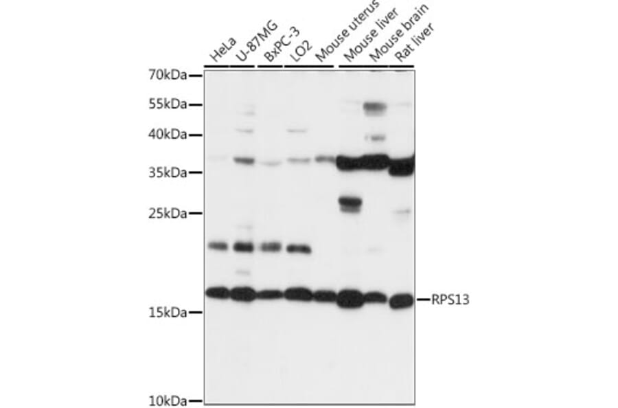 Western Blot - Anti-RPS13 Antibody (A88552) - Antibodies.com