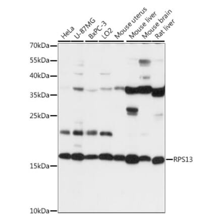 Western Blot - Anti-RPS13 Antibody (A88552) - Antibodies.com