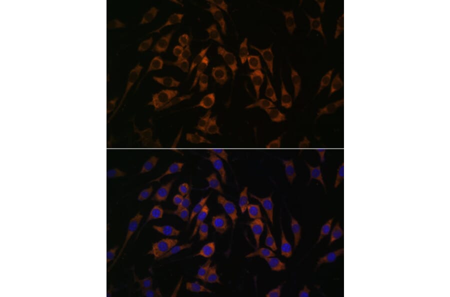 Immunofluorescence - Anti-RPS13 Antibody (A88552) - Antibodies.com