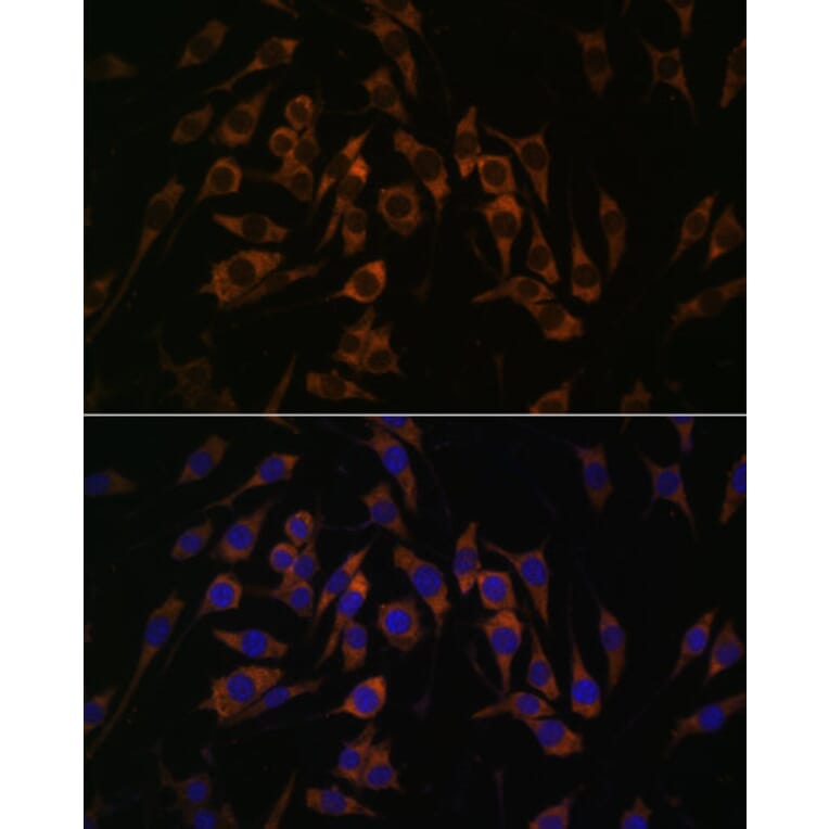 Immunofluorescence - Anti-RPS13 Antibody (A88552) - Antibodies.com