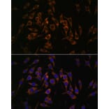 Immunofluorescence - Anti-RPS13 Antibody (A88552) - Antibodies.com