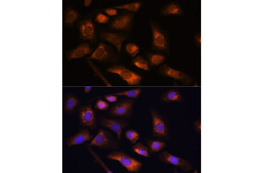Immunofluorescence - Anti-RPS13 Antibody (A88552) - Antibodies.com