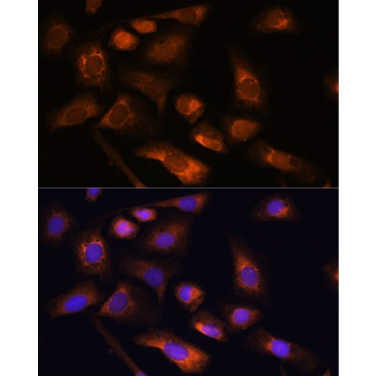 Immunofluorescence - Anti-RPS13 Antibody (A88552) - Antibodies.com