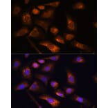 Immunofluorescence - Anti-RPS13 Antibody (A88552) - Antibodies.com