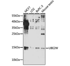 Western Blot - Anti-UBE2W Antibody (A88553) - Antibodies.com