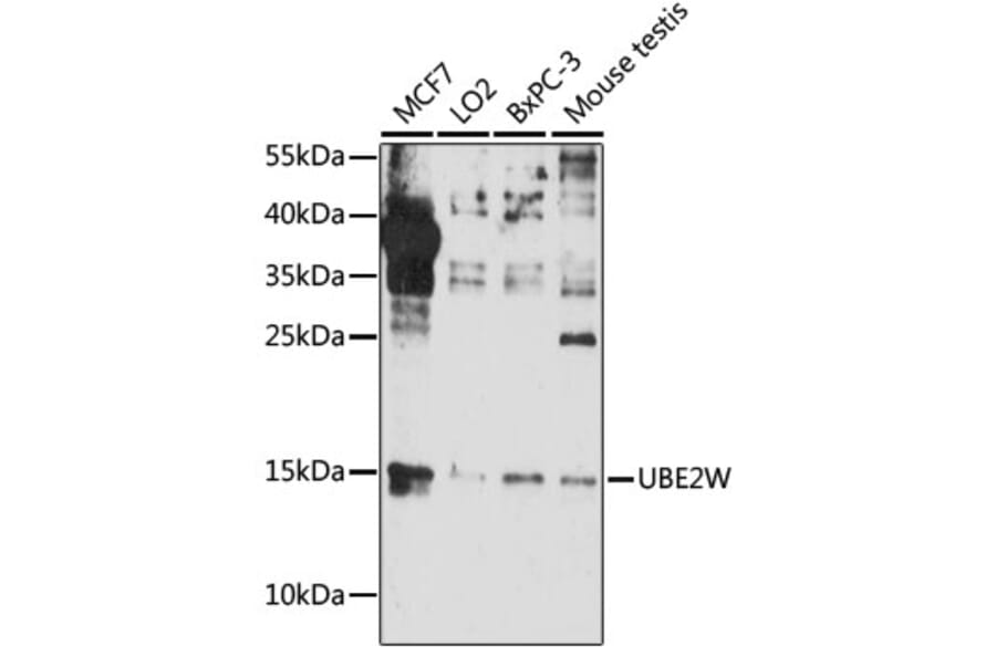 Western Blot - Anti-UBE2W Antibody (A88553) - Antibodies.com
