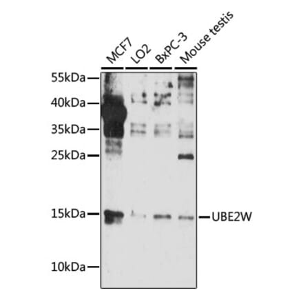 Western Blot - Anti-UBE2W Antibody (A88553) - Antibodies.com