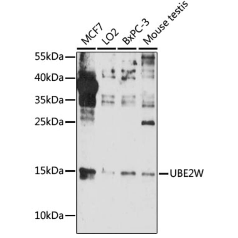 Western Blot - Anti-UBE2W Antibody (A88553) - Antibodies.com
