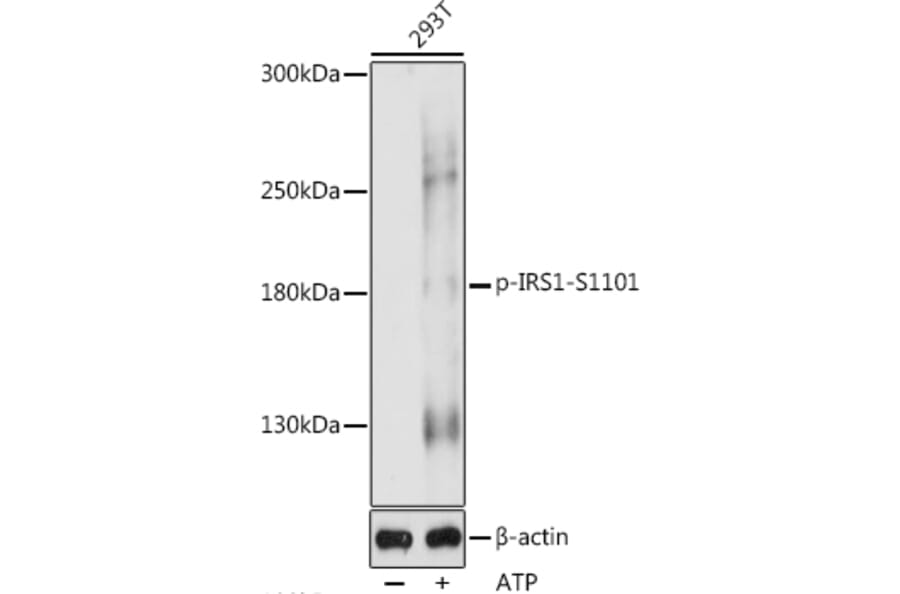 Western Blot - Anti-IRS1 (phospho Ser1101) Antibody (A88554) - Antibodies.com
