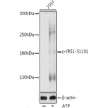 Western Blot - Anti-IRS1 (phospho Ser1101) Antibody (A88554) - Antibodies.com