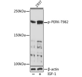 Western Blot - Anti-PERK (phospho Thr982) Antibody (A88555) - Antibodies.com