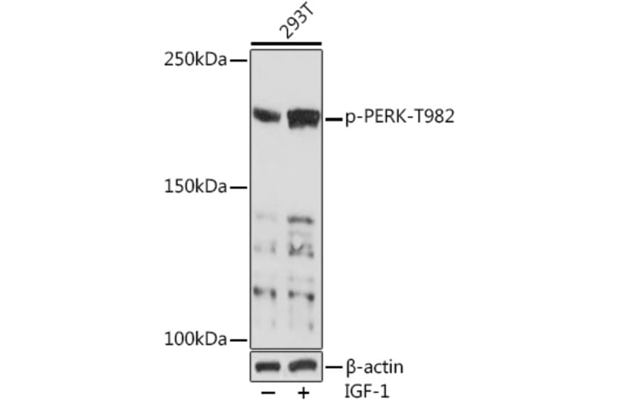 Western Blot - Anti-PERK (phospho Thr982) Antibody (A88555) - Antibodies.com