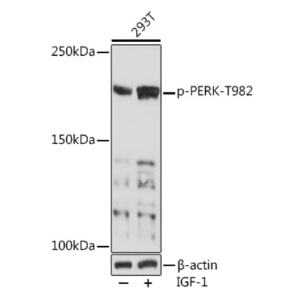 Western Blot - Anti-PERK (phospho Thr982) Antibody (A88555) - Antibodies.com
