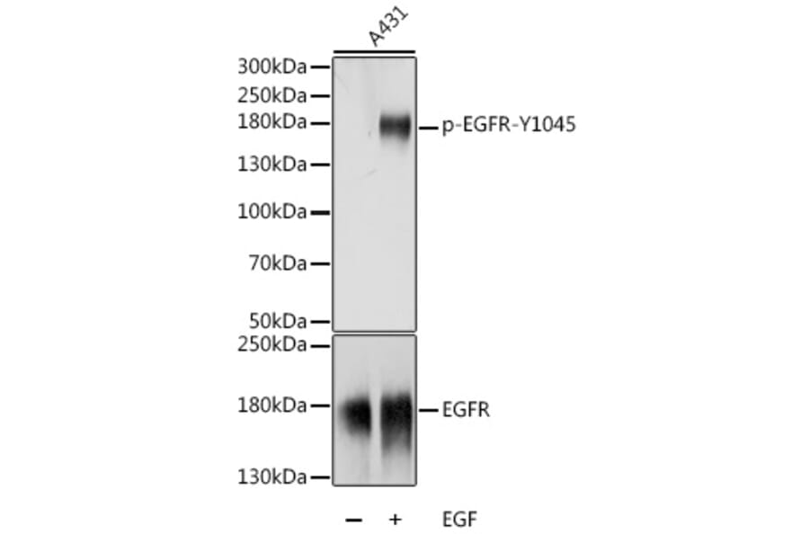 Western Blot - Anti-EGFR (phospho Tyr1045) Antibody (A88556) - Antibodies.com