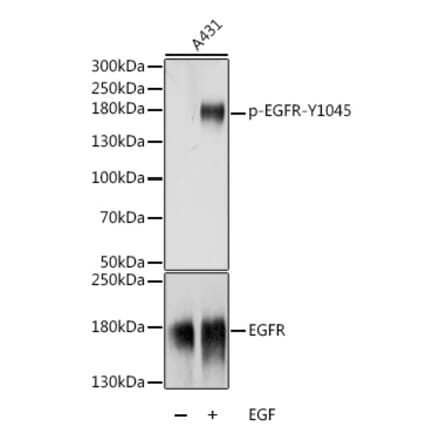 Western Blot - Anti-EGFR (phospho Tyr1045) Antibody (A88556) - Antibodies.com