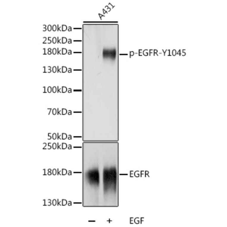 Western Blot - Anti-EGFR (phospho Tyr1045) Antibody (A88556) - Antibodies.com