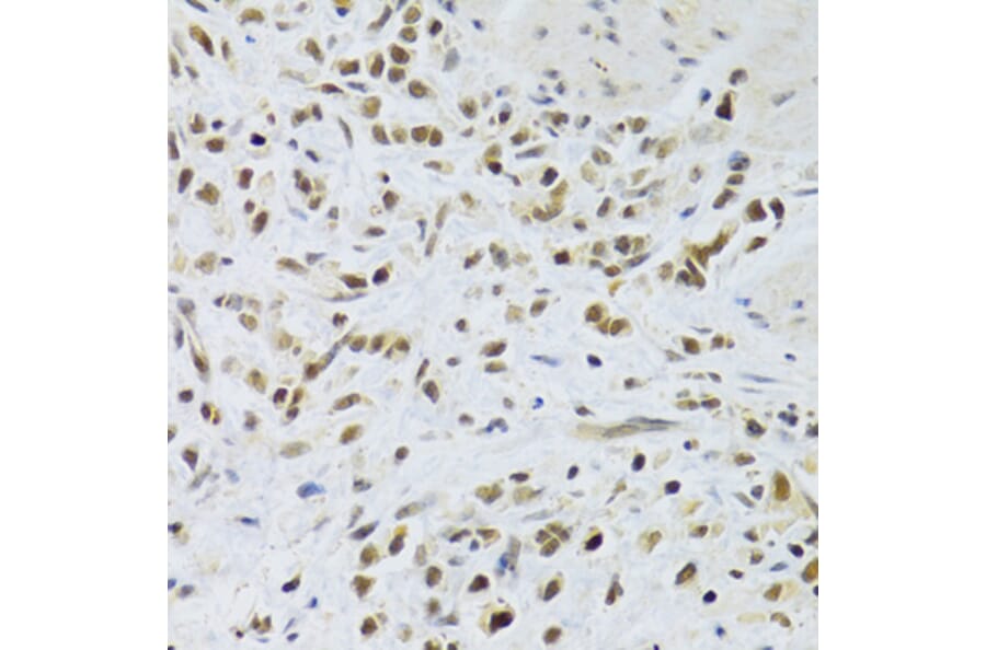 Immunohistochemistry - Anti-Rad50 Antibody (A88557) - Antibodies.com