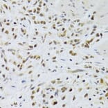 Immunohistochemistry - Anti-Rad50 Antibody (A88557) - Antibodies.com