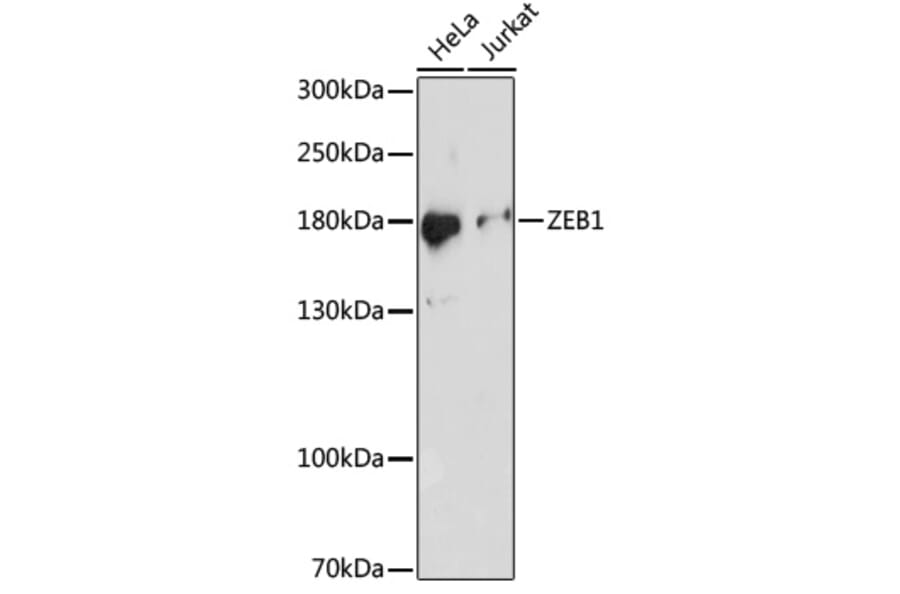 Western Blot - Anti-ZEB1 Antibody (A88558) - Antibodies.com
