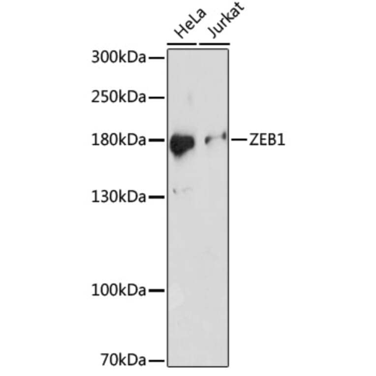 Western Blot - Anti-ZEB1 Antibody (A88558) - Antibodies.com