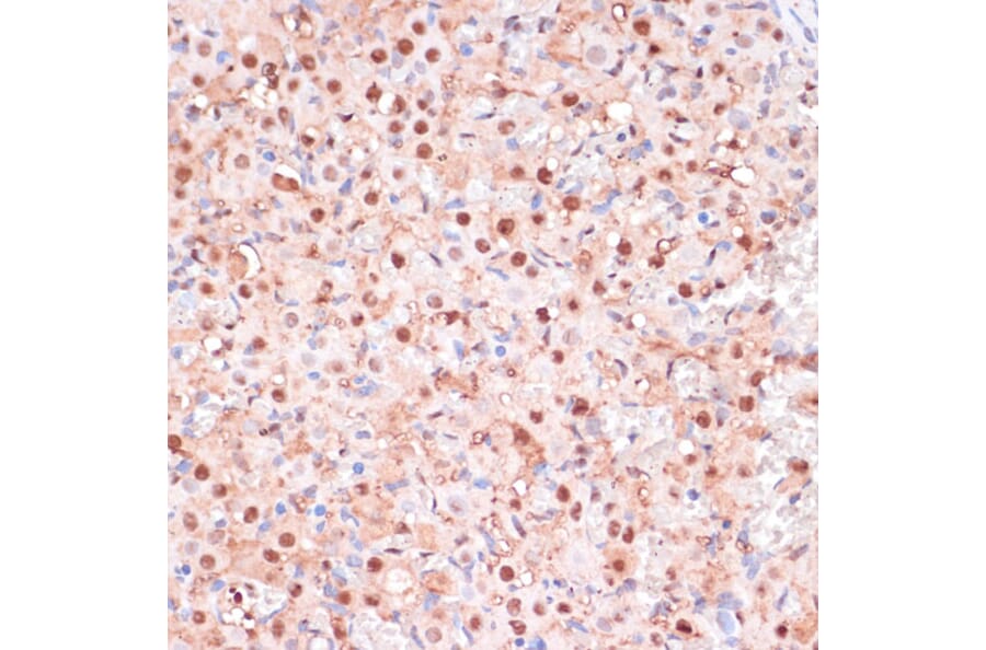 Immunohistochemistry - Anti-ZEB1 Antibody (A88558) - Antibodies.com