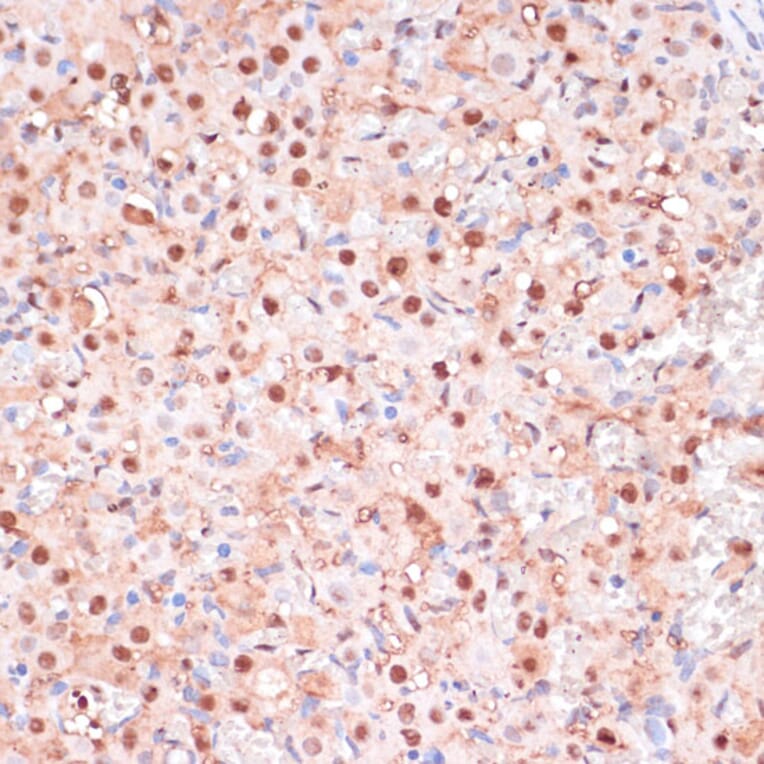 Immunohistochemistry - Anti-ZEB1 Antibody (A88558) - Antibodies.com