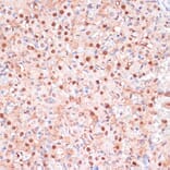 Immunohistochemistry - Anti-ZEB1 Antibody (A88558) - Antibodies.com