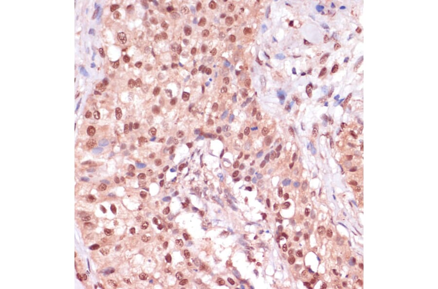 Immunohistochemistry - Anti-ZEB1 Antibody (A88558) - Antibodies.com