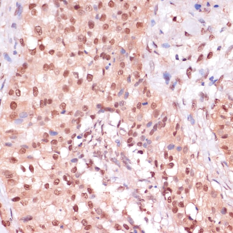 Immunohistochemistry - Anti-ZEB1 Antibody (A88558) - Antibodies.com