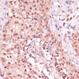 Immunohistochemistry - Anti-ZEB1 Antibody (A88558) - Antibodies.com