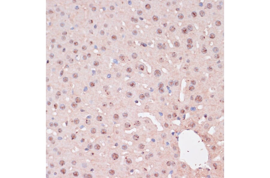 Immunohistochemistry - Anti-ZEB1 Antibody (A88558) - Antibodies.com
