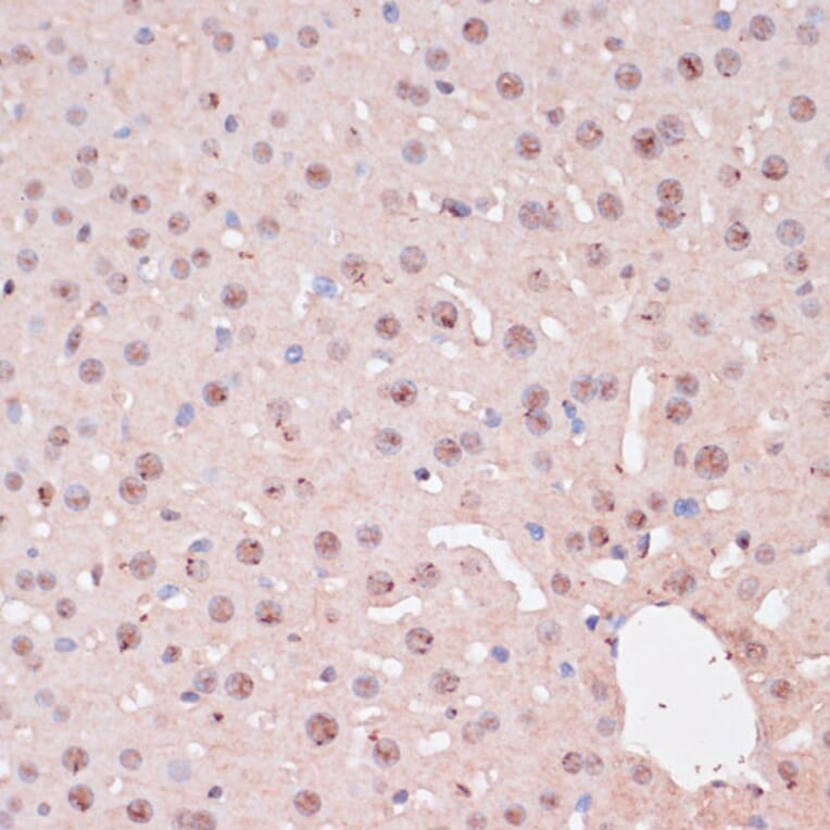Immunohistochemistry - Anti-ZEB1 Antibody (A88558) - Antibodies.com