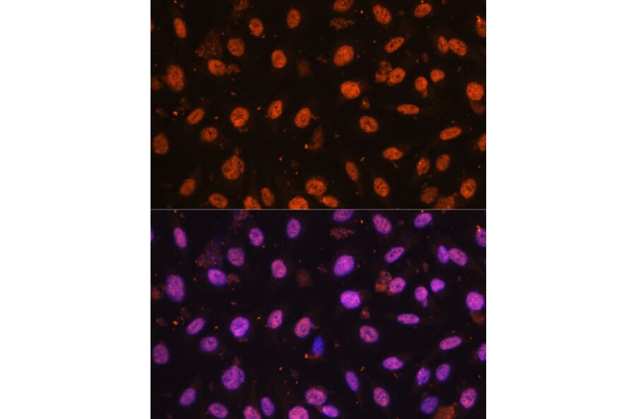 Immunofluorescence - Anti-ZEB1 Antibody (A88558) - Antibodies.com